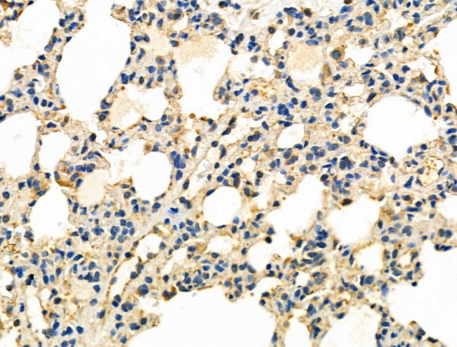 RNA pol II CTD Antibody in Immunohistochemistry (Paraffin) (IHC (P))