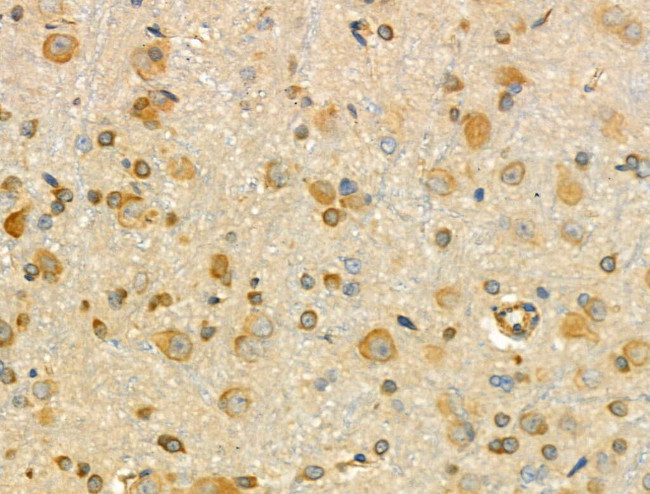 RNA pol II CTD Antibody in Immunohistochemistry (Paraffin) (IHC (P))