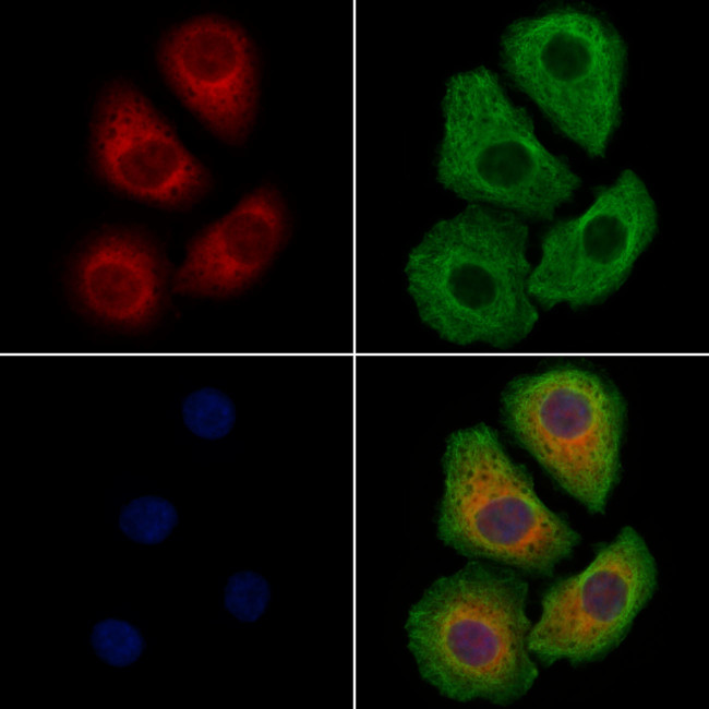 HDJ2 Antibody in Immunocytochemistry (ICC/IF)