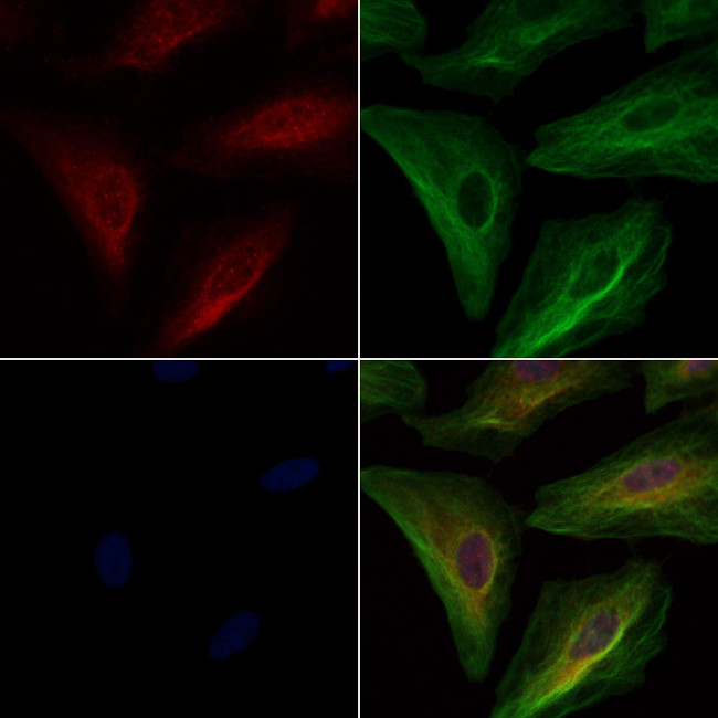 DOCK2 Antibody in Immunocytochemistry (ICC/IF)