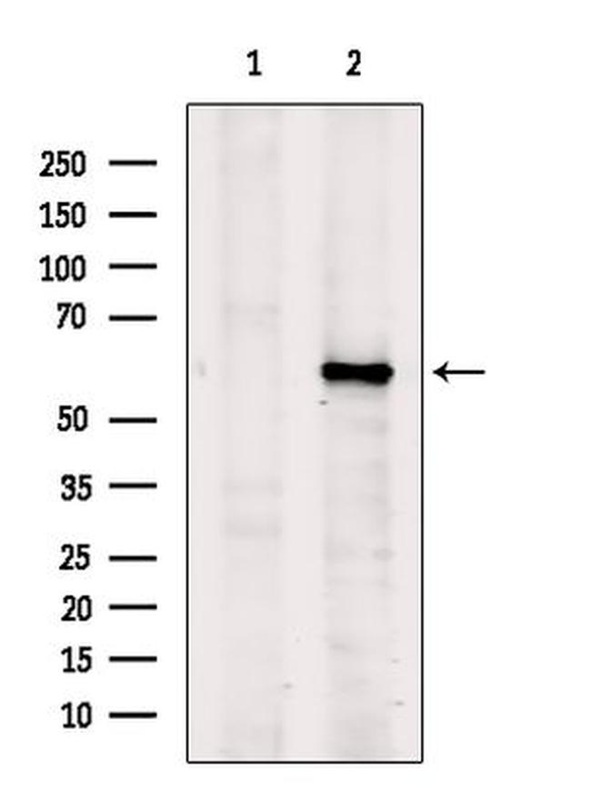 DOK7 Antibody in Western Blot (WB)