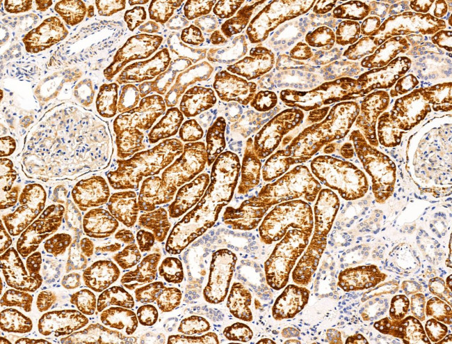 DPP6 Antibody in Immunohistochemistry (Paraffin) (IHC (P))