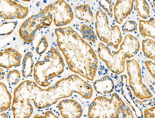 DRD2 Antibody in Immunohistochemistry (Paraffin) (IHC (P))