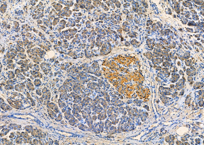 Desmoglein 3 Antibody in Immunohistochemistry (Paraffin) (IHC (P))