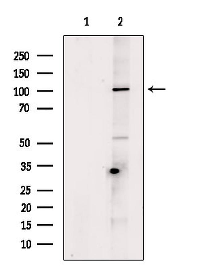 Desmoglein 3 Antibody in Western Blot (WB)