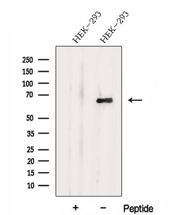 DTX4 Antibody in Western Blot (WB)