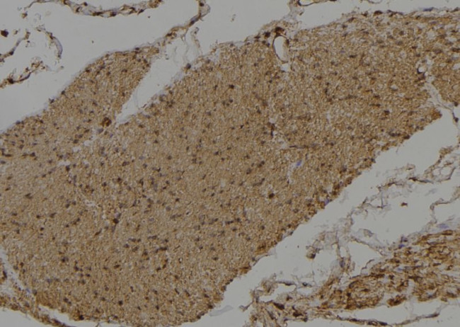 DVL3 Antibody in Immunohistochemistry (Paraffin) (IHC (P))