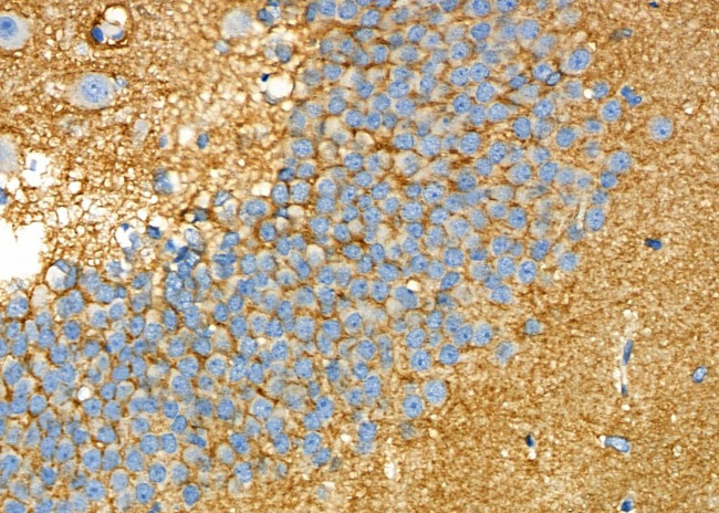 DYNC1H1 Antibody in Immunohistochemistry (Paraffin) (IHC (P))