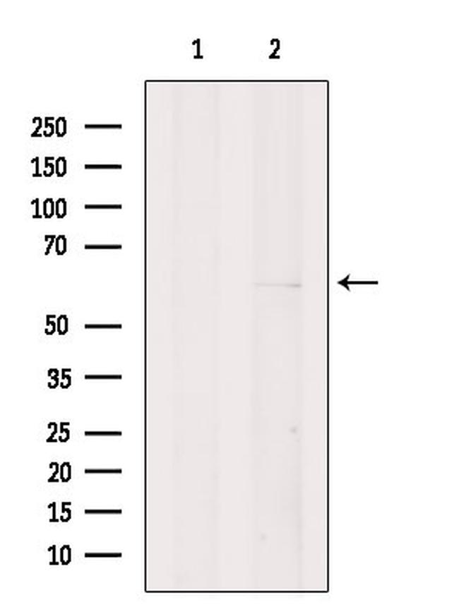 EBF2 Antibody in Western Blot (WB)