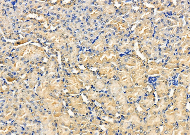 EBI3 Antibody in Immunohistochemistry (Paraffin) (IHC (P))