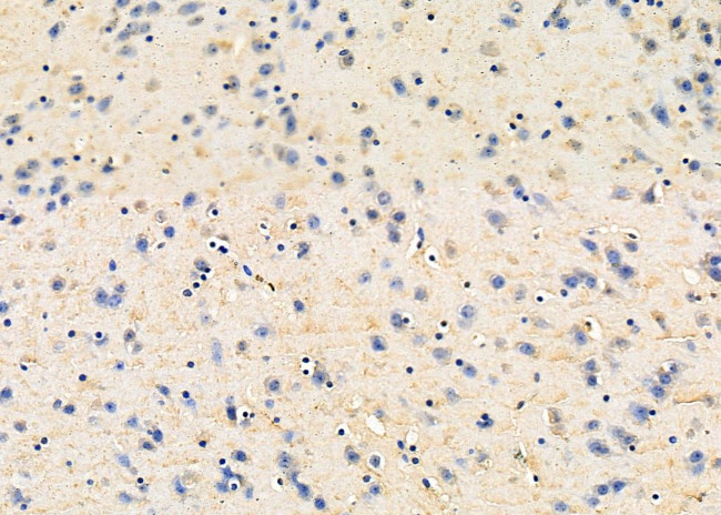 EBI3 Antibody in Immunohistochemistry (Paraffin) (IHC (P))