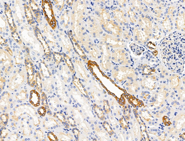 ECM2 Antibody in Immunohistochemistry (Paraffin) (IHC (P))