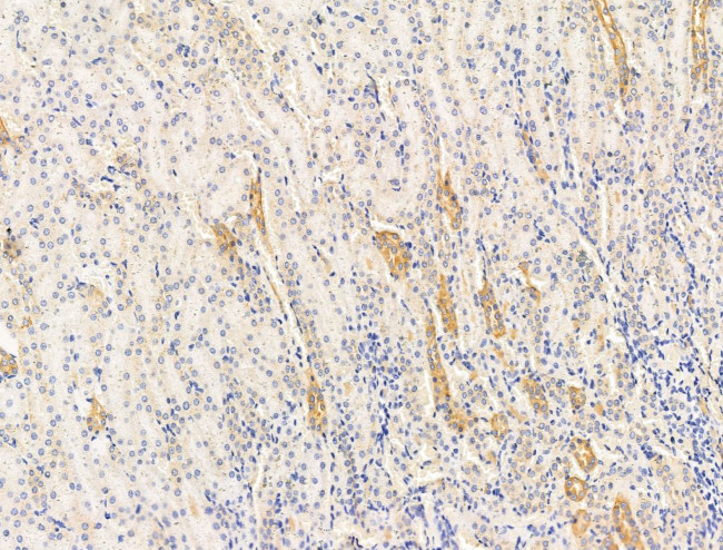 ECM2 Antibody in Immunohistochemistry (Paraffin) (IHC (P))