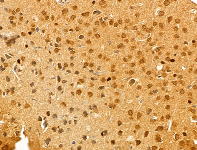 ECSIT Antibody in Immunohistochemistry (Paraffin) (IHC (P))