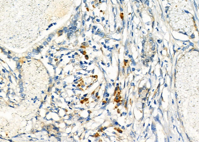 EDEM3 Antibody in Immunohistochemistry (Paraffin) (IHC (P))