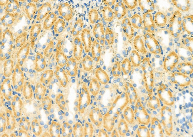 EDEM3 Antibody in Immunohistochemistry (Paraffin) (IHC (P))