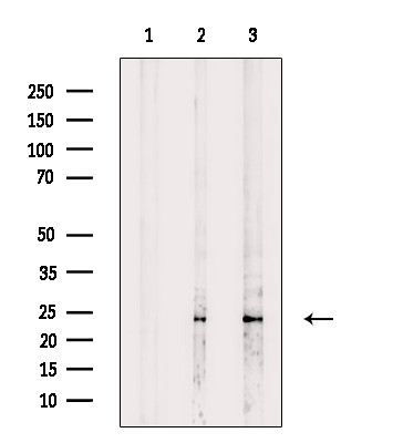 EEF1B2 Antibody in Western Blot (WB)