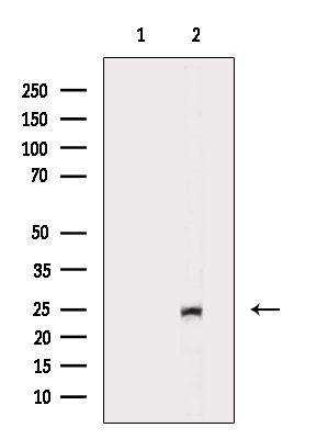 EEF1B2 Antibody in Western Blot (WB)