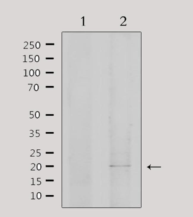 EID1 Antibody in Western Blot (WB)