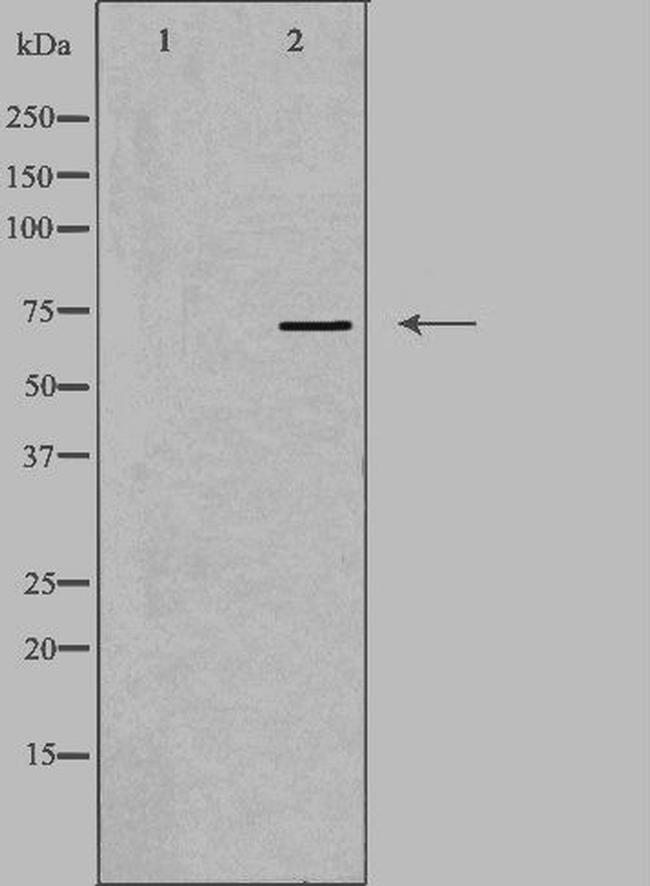 HRI Antibody in Western Blot (WB)