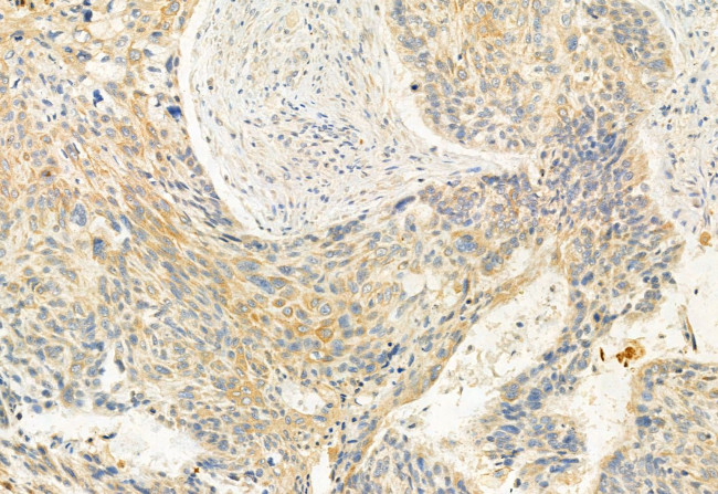 eIF4A3 Antibody in Immunohistochemistry (Paraffin) (IHC (P))