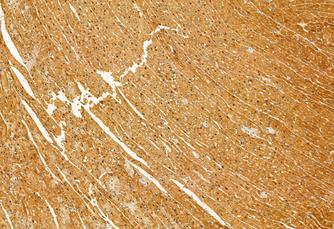 eIF4A3 Antibody in Immunohistochemistry (Paraffin) (IHC (P))