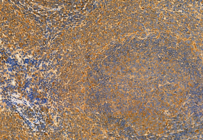 eIF4A3 Antibody in Immunohistochemistry (Paraffin) (IHC (P))