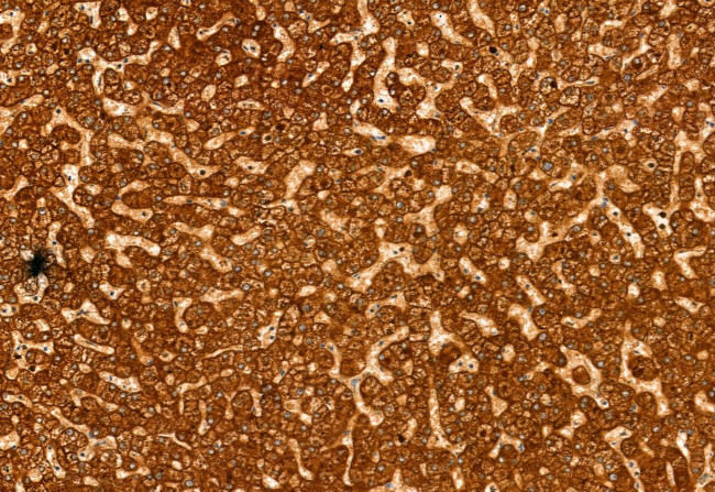 eIF4A3 Antibody in Immunohistochemistry (Paraffin) (IHC (P))