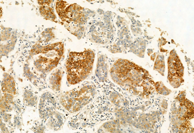 eIF4A3 Antibody in Immunohistochemistry (Paraffin) (IHC (P))