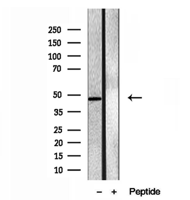 eIF4A3 Antibody in Western Blot (WB)