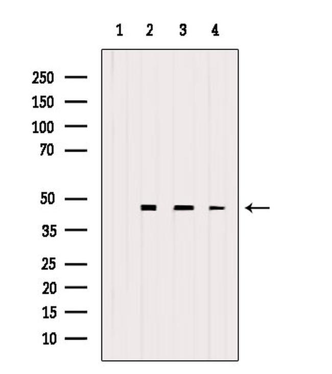 eIF4A3 Antibody in Western Blot (WB)