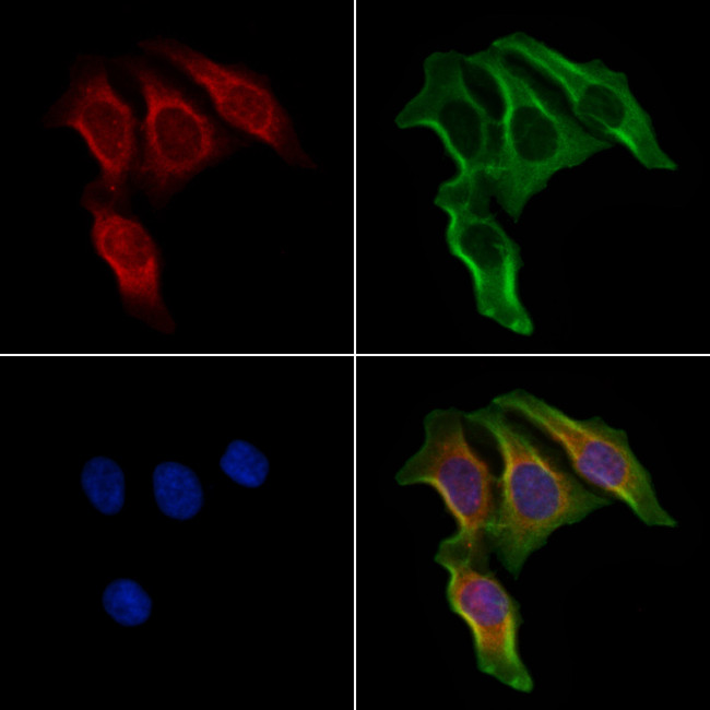 ELOVL5 Antibody in Immunocytochemistry (ICC/IF)