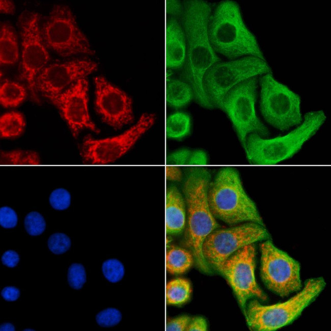 ENAH Antibody in Immunocytochemistry (ICC/IF)