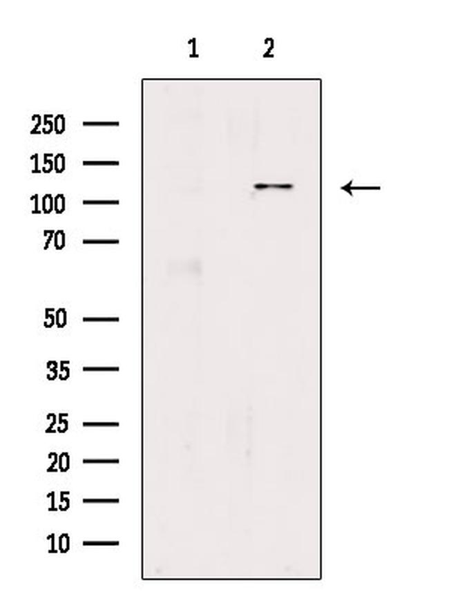 EPHA3 Antibody in Western Blot (WB)