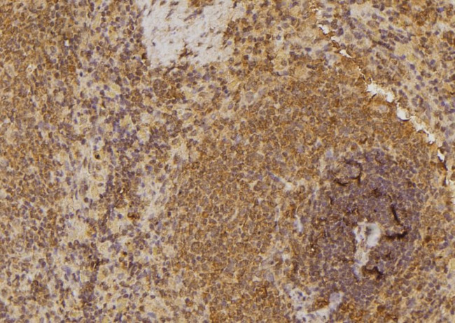 EphA6 Antibody in Immunohistochemistry (Paraffin) (IHC (P))