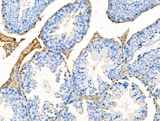 EphB2 Antibody in Immunohistochemistry (Paraffin) (IHC (P))