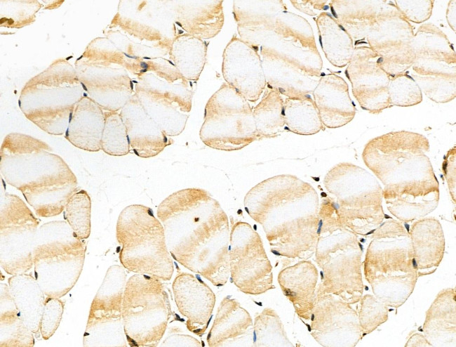 EphB2 Antibody in Immunohistochemistry (Paraffin) (IHC (P))