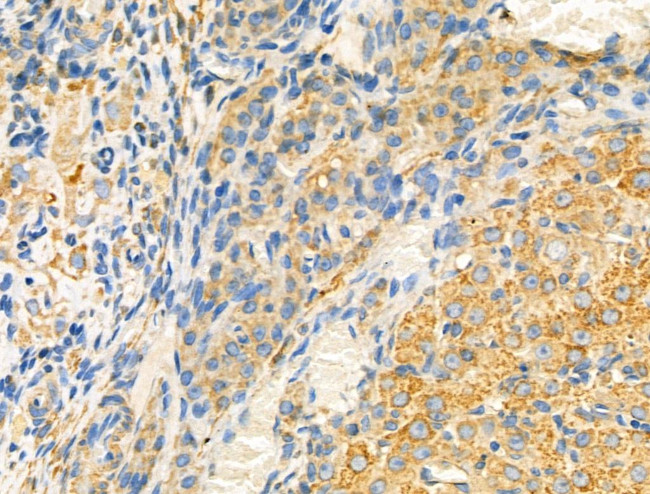 EphB2 Antibody in Immunohistochemistry (Paraffin) (IHC (P))