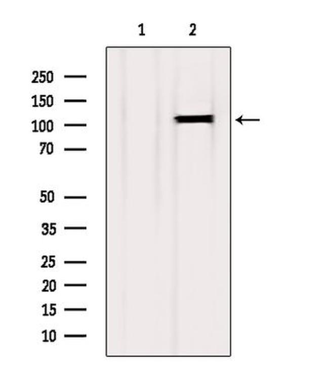 EphB2 Antibody in Western Blot (WB)