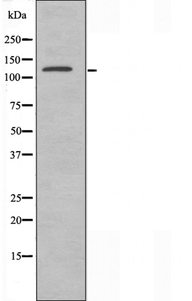 XPG Antibody in Western Blot (WB)