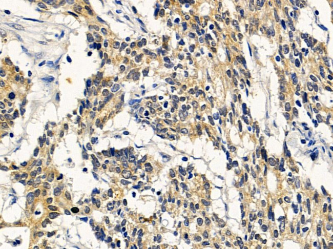 ERLIN1 Antibody in Immunohistochemistry (Paraffin) (IHC (P))