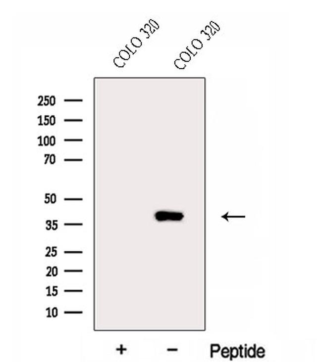 ERLIN1 Antibody in Western Blot (WB)