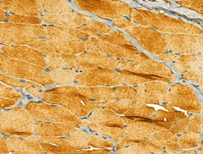 ERLIN2 Antibody in Immunohistochemistry (Paraffin) (IHC (P))