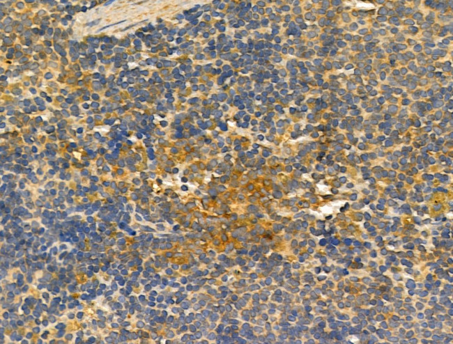 ERLIN2 Antibody in Immunohistochemistry (Paraffin) (IHC (P))