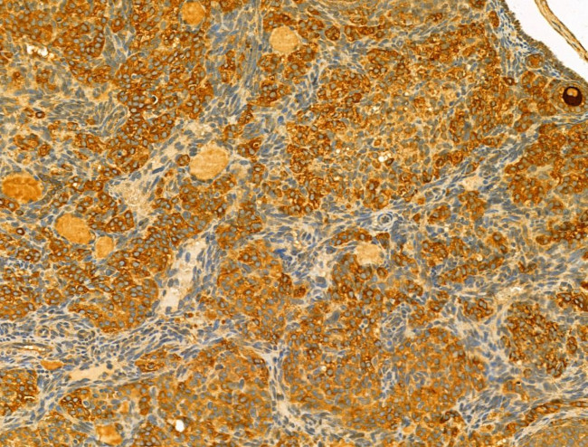 ERLIN2 Antibody in Immunohistochemistry (Paraffin) (IHC (P))