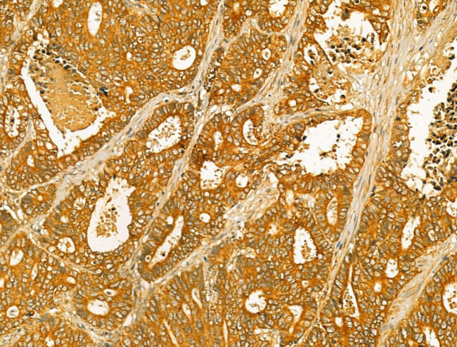 ERLIN2 Antibody in Immunohistochemistry (Paraffin) (IHC (P))