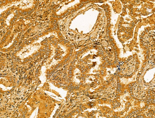 ERLIN2 Antibody in Immunohistochemistry (Paraffin) (IHC (P))