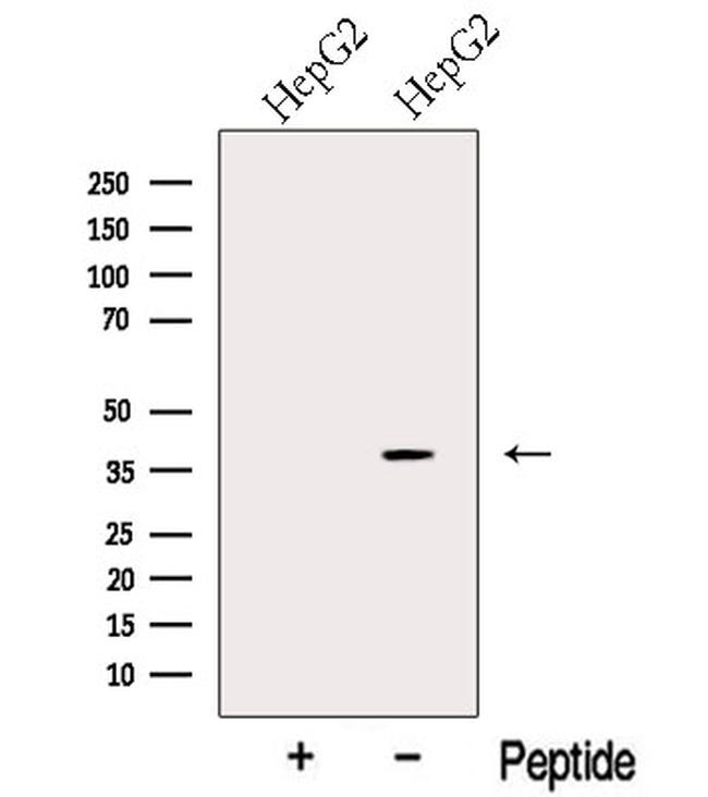 ERLIN2 Antibody in Western Blot (WB)