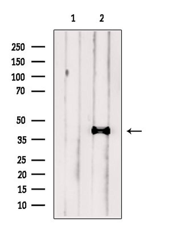 ESD Antibody in Western Blot (WB)