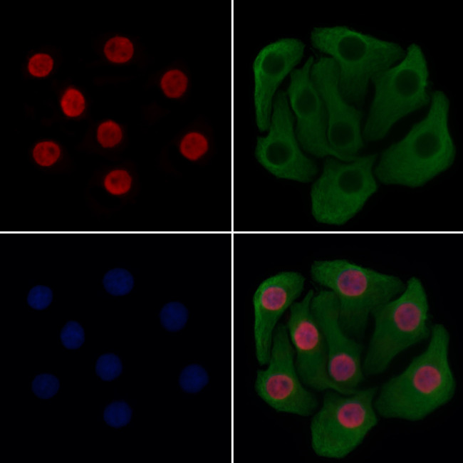 XPO5 Antibody in Immunocytochemistry (ICC/IF)